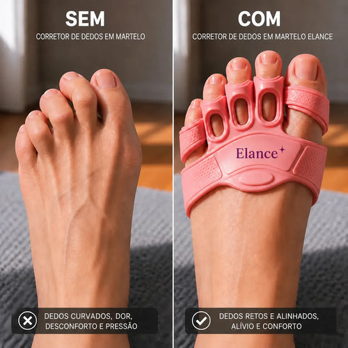 Élance™ – Corretor para Joanetes