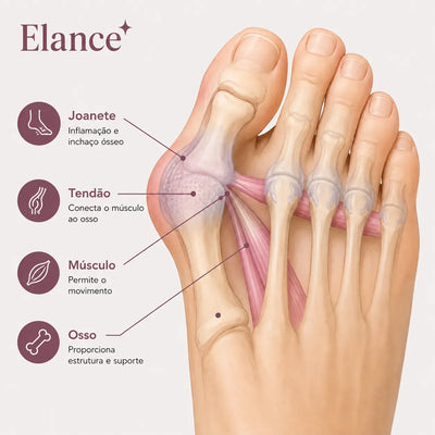 Élance™ – Corretor para Joanetes