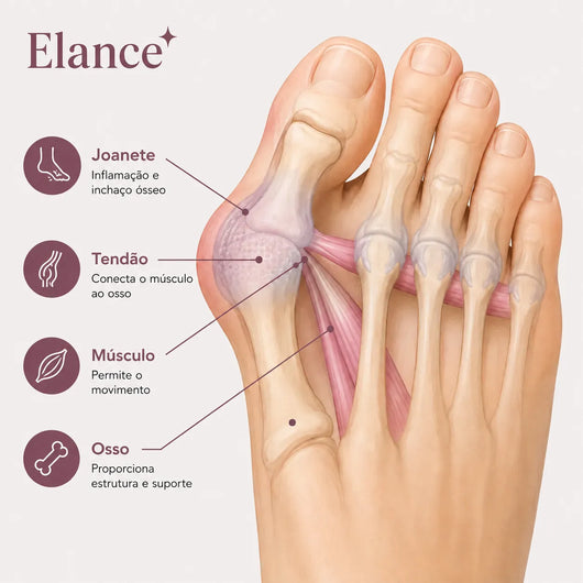 Élance™ – Corretor para Joanetes