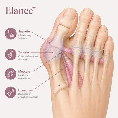 Élance™ Corrector de Juanetes